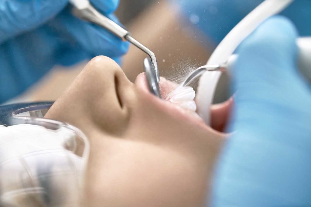 Do Dental Assistants Clean Teeth? (Answered) UEI College